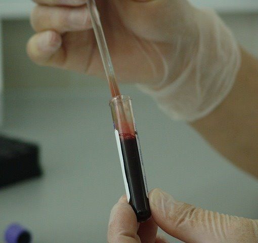 Australia financia estudios del tratamiento del cáncer con cannabis